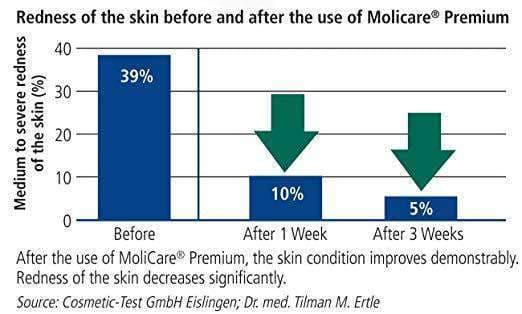 MoliCare Premium Mobile Adult Unisex Underwear - Moderate Absorbency Case of 56 - primehubstore.shop Incontinence